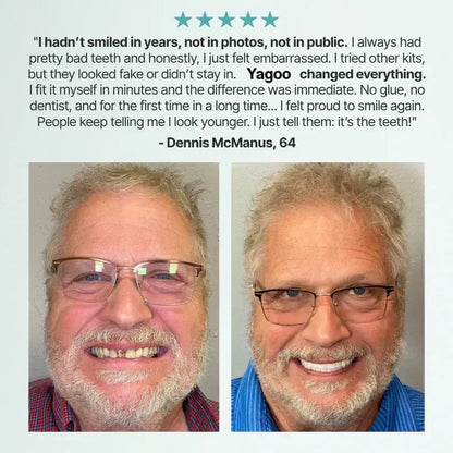 ⏰Ends Today: 70% OFF! 🌎KLENIMORE™ Custom-Fit  Dentures— Designed for Comfort and a Natural-Looking Smile